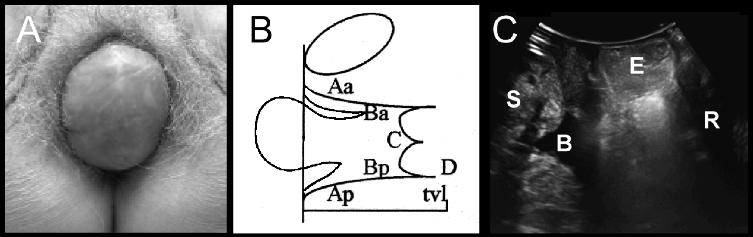 fig5.png