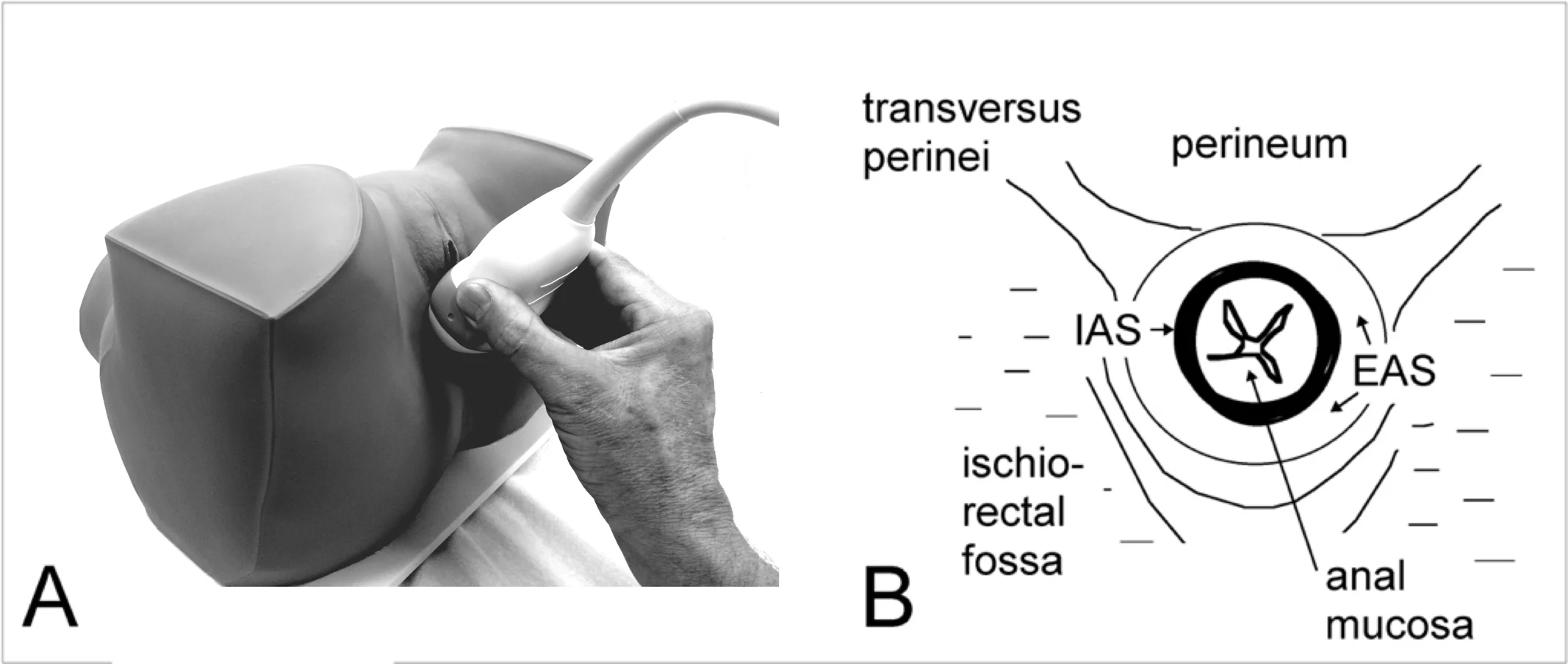 The Anal Sphincter fig 1.jpg