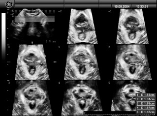 fig 2 3D-4D Ultrasound.jpg