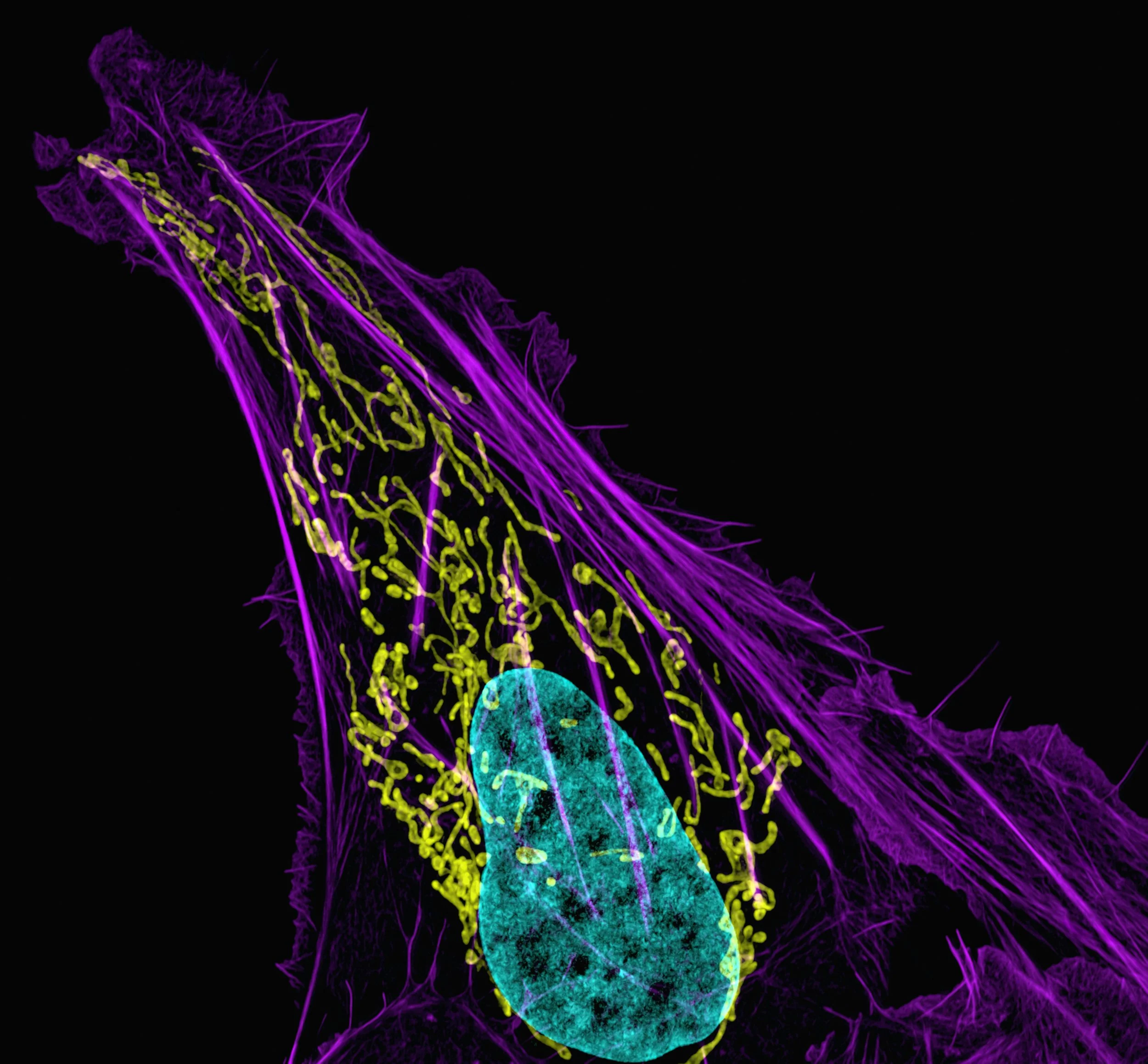 Drugging the Undruggable: How PROTACs Hijack Cellular Machinery to Destroy Cancer