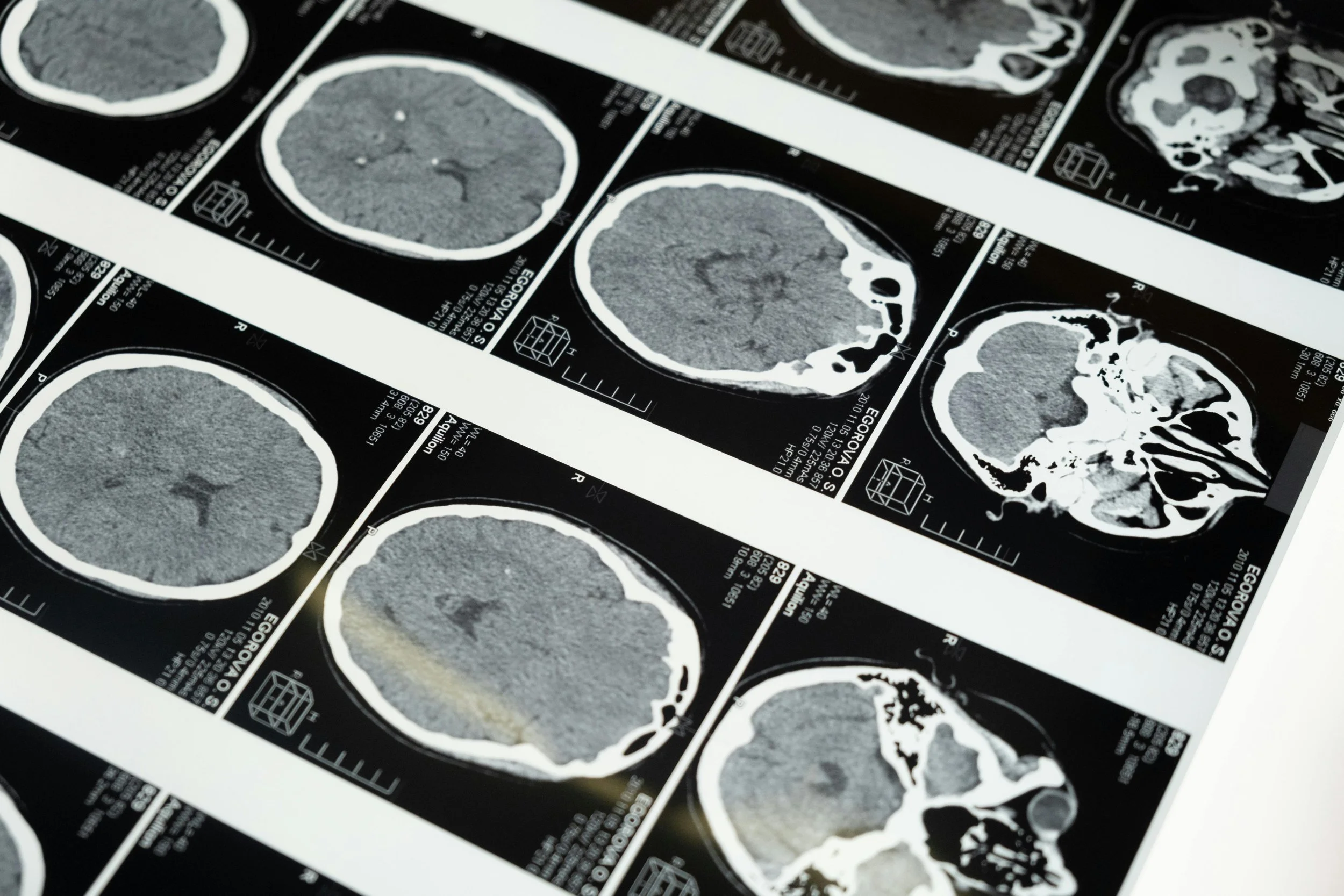 Works Like A CHARM: A Step Towards Finding a Cure for Deadly Prion Diseases