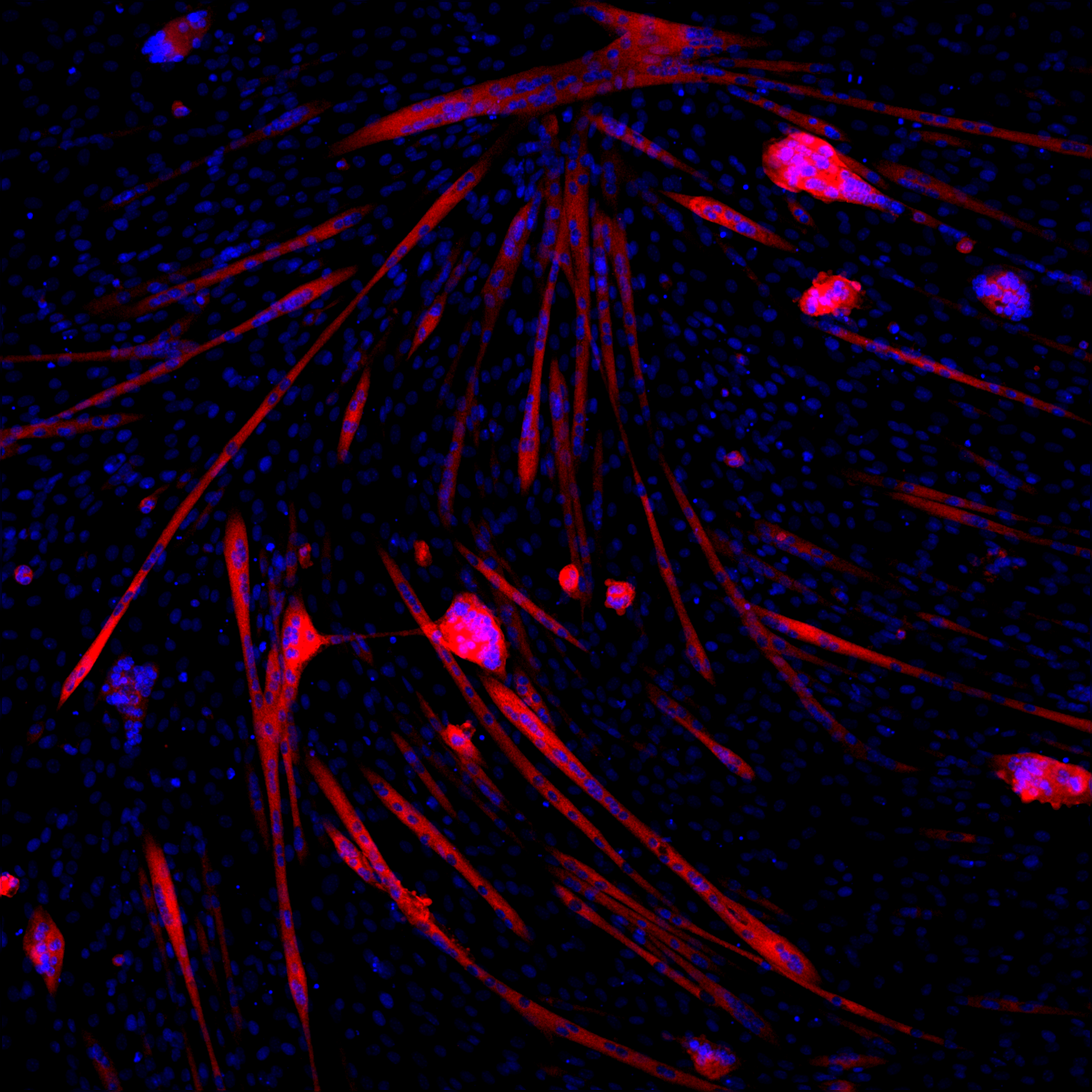 IMATINIB 1 10X_Multifocus Image.png
