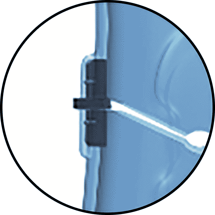 Motion Stop Plantarflexion 1
