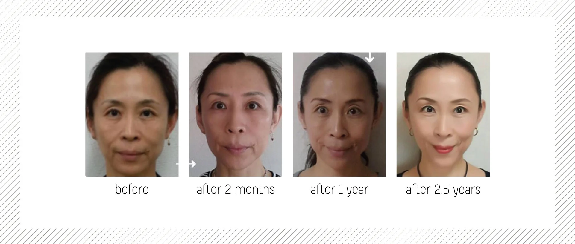skin-fit-gym_home_before-and-after-01.1.jpg