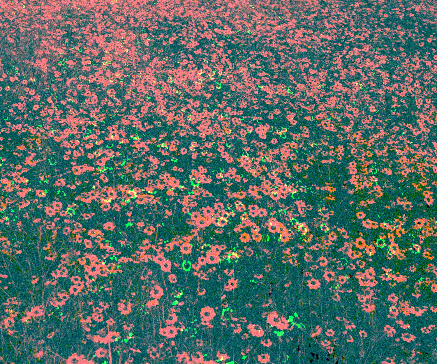 Notes On Staying/No One Is Making Their Best Work When They Want To Die