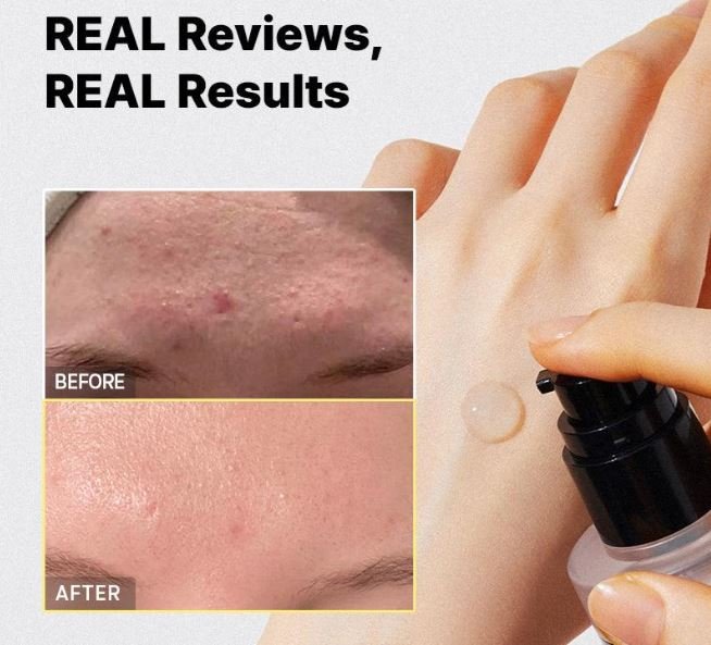 COSRXSMPRE_COSRX Snail Mucin Power Repair Essence_skin demo2.JPG