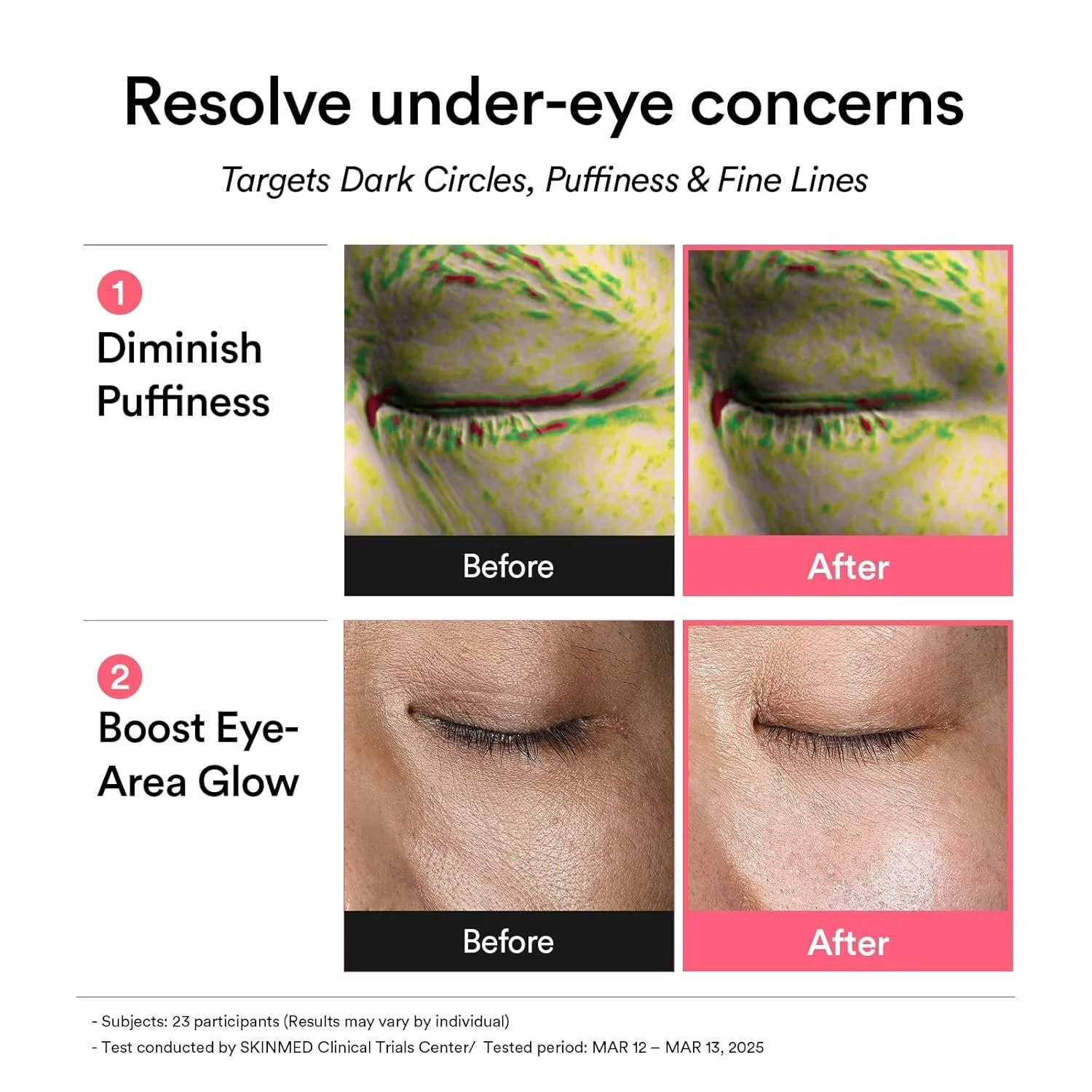 ABPDRNEPGJ_Abib PDRN Retinal Eye Patches_SKIN concerns 2.jpg