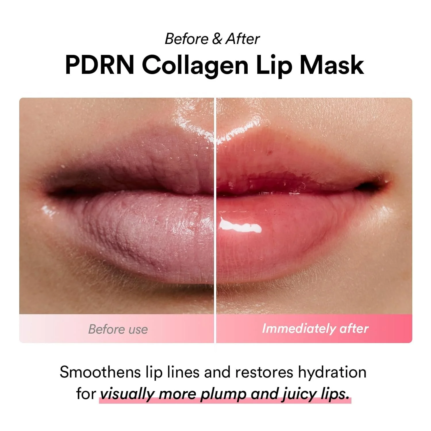 ABPDRNCLMK_Abib PDRN Collagen Lip Mask Glazed Jelly_before-after.jpg
