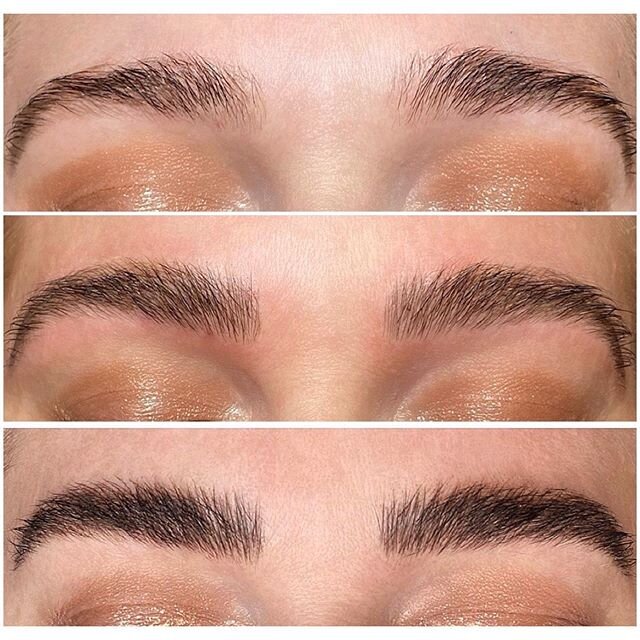 Process Photo: Before, After 1st Session, After 2nd Session. I&rsquo;ve Explained This Many Times, &amp; I&rsquo;ll Continue To Explain it As Long As Needed 😉...Microblading is a 2-3 Session Process, With an 8-10 Week Break Between Sessions. I Liken