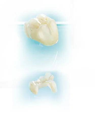 tooth.jpg