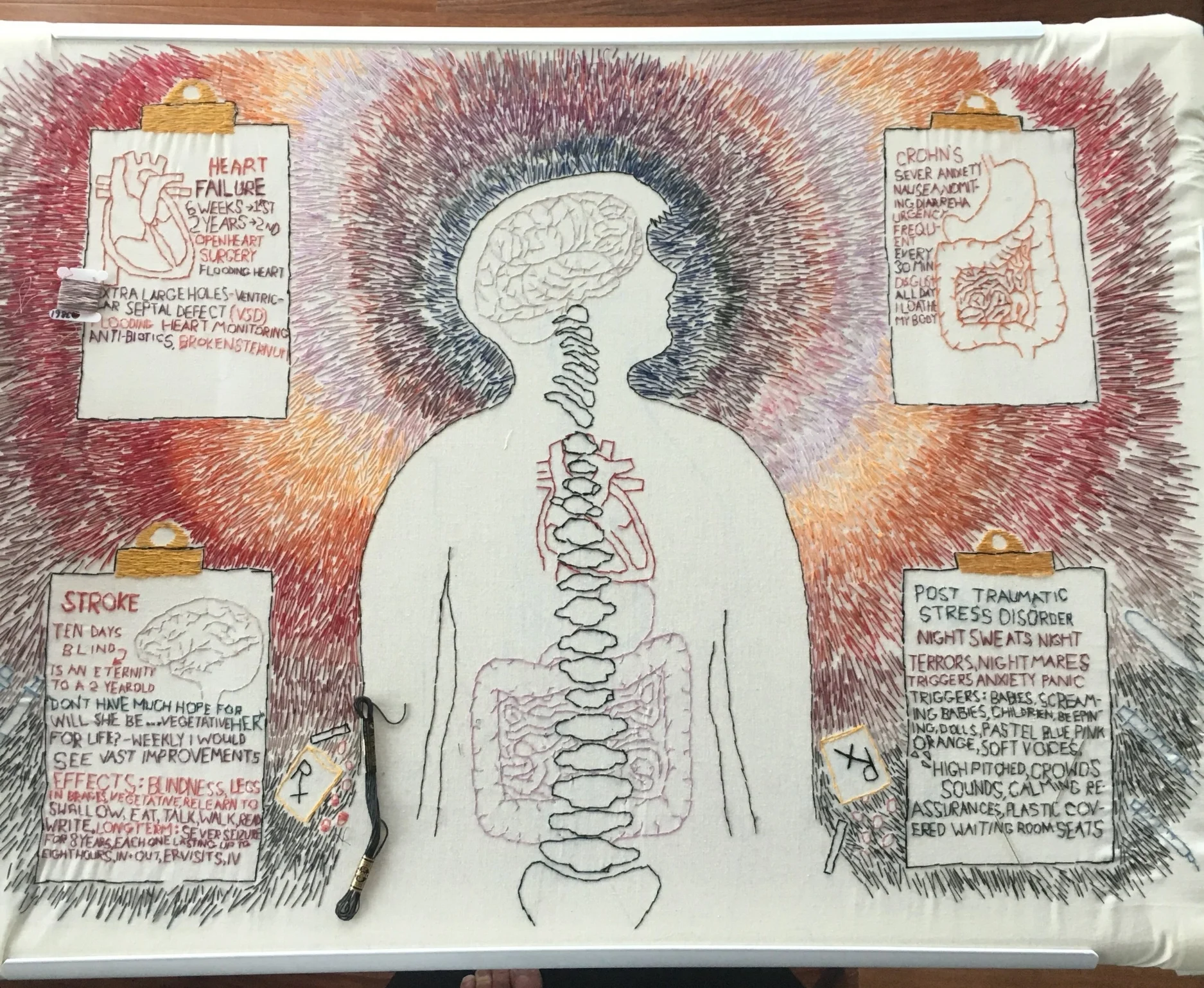 June 2018 - Second Large Embroidery - What the Mirror Doesn't See, Part 2 - Nervous System &amp; PTSD