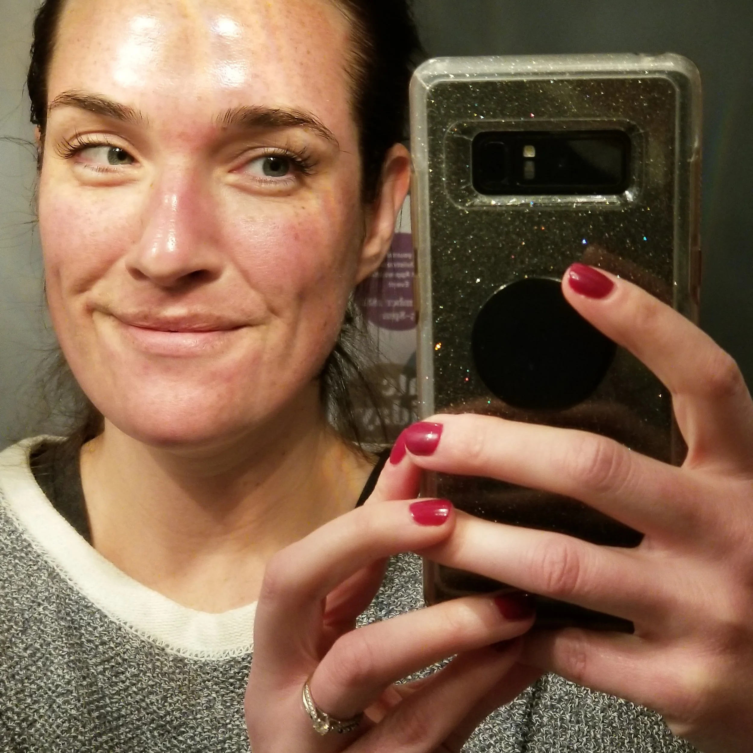Dr. White immediately after her first Innopen treatment.