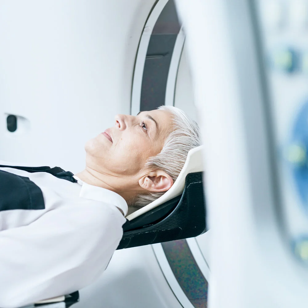 “Incidentalomas”: How Brain MRI Can Complicate Migraine Management