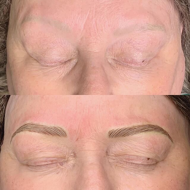 Hyper-realism hair-stroke simulation tattoo to create natural looking brows on our beautiful client with #alopecia 
In this case we were working over previous tattoo and correcting symmetry 🤗
.
.
.
.
.
#loveourjob #alopeciaawareness #thebrowstylists