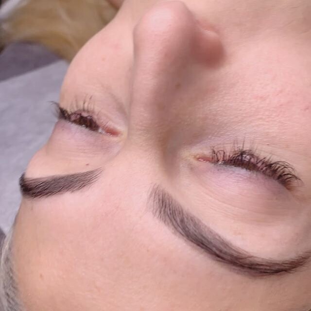 💫HEALED OMBR&Eacute; BROWS 💫
➡️ Swipe for before &amp; immediately after photos. Although brows are dark and bold post procedure, healed result can be a soft powdered mist effect 💫
Now booking into August/September Afterpay available 💰 
Visit us 
