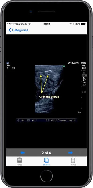 Quality labelled still ultrasound images.