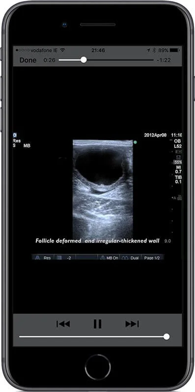 Quality video illustrating ultrasound findings.