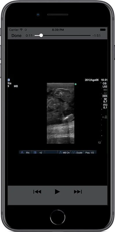 Clear video loops illustrating each feature.