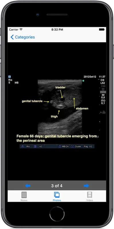 Quality labelled still ultrasound images.