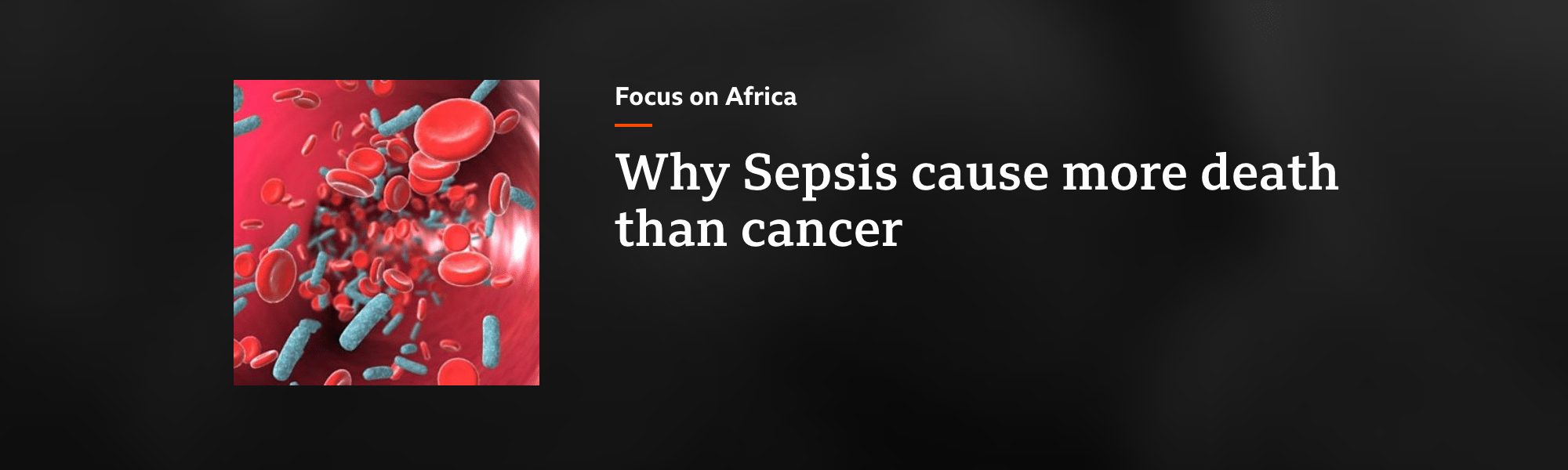 Emmanuel Nsutebu on BBC's Focus on Africa Regarding Sepsis in Africa