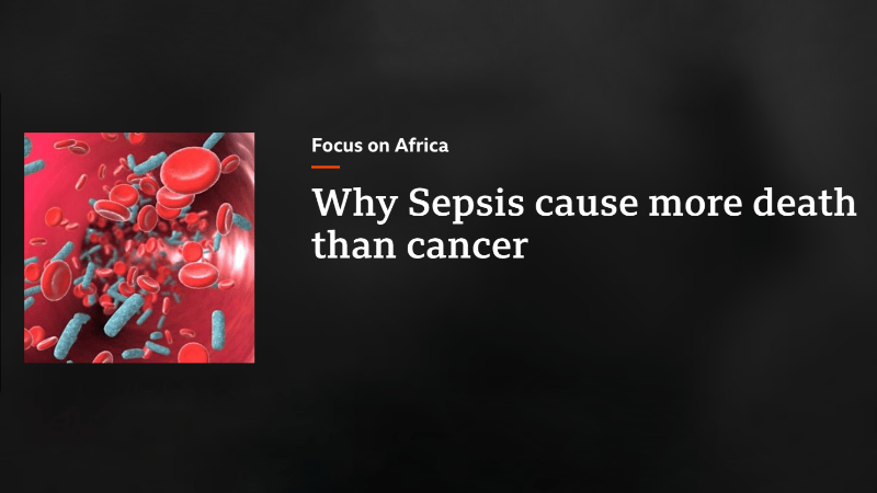Emmanuel Nsutebu on BBC's Focus on Africa Regarding Sepsis in Africa