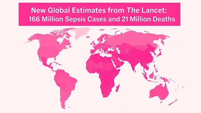 New Global Estimates from The Lancet: 166 Million Sepsis Cases and 21 Million Deaths