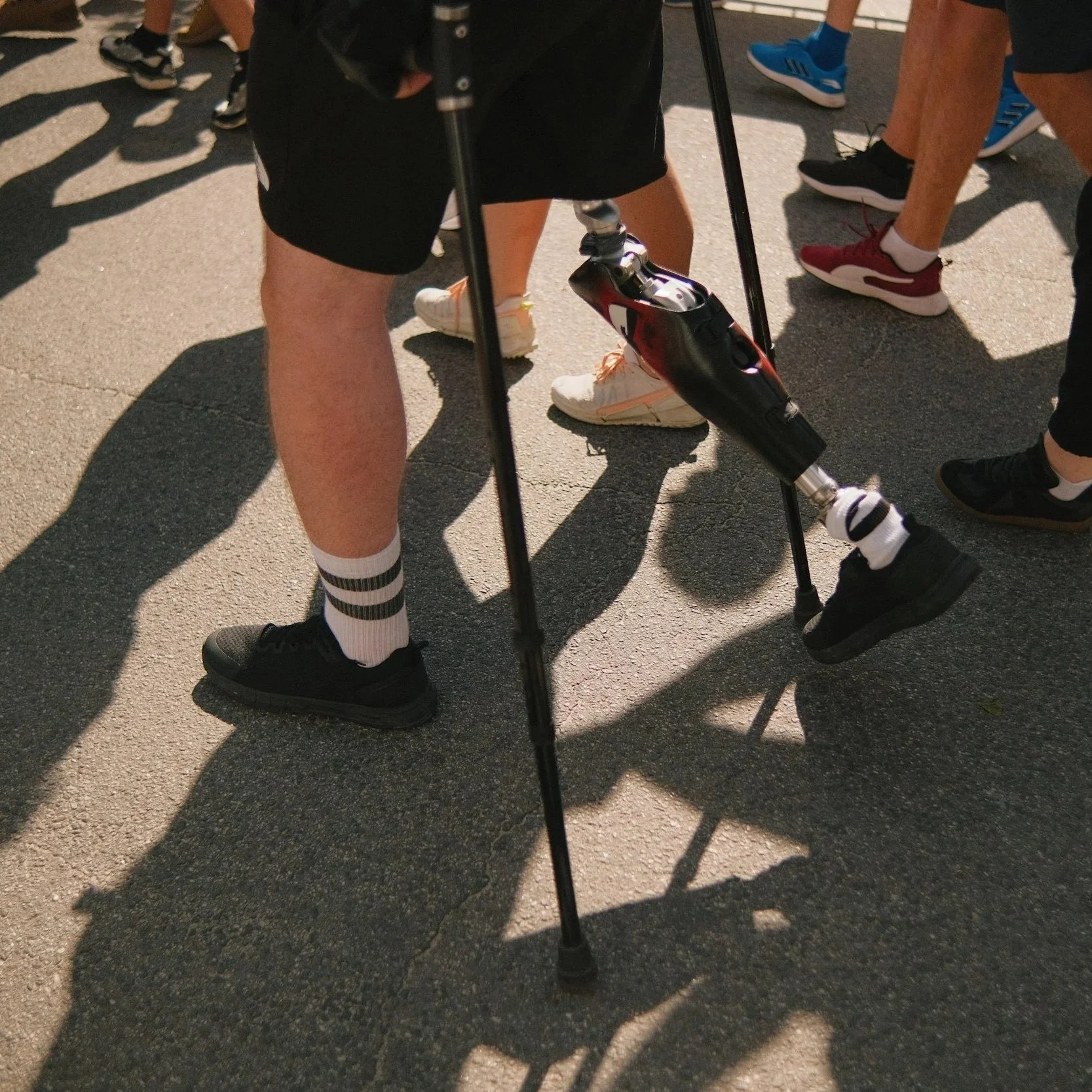 Balancing Act: The Science and Support Behind Orthotic and Prosthetic Rehab