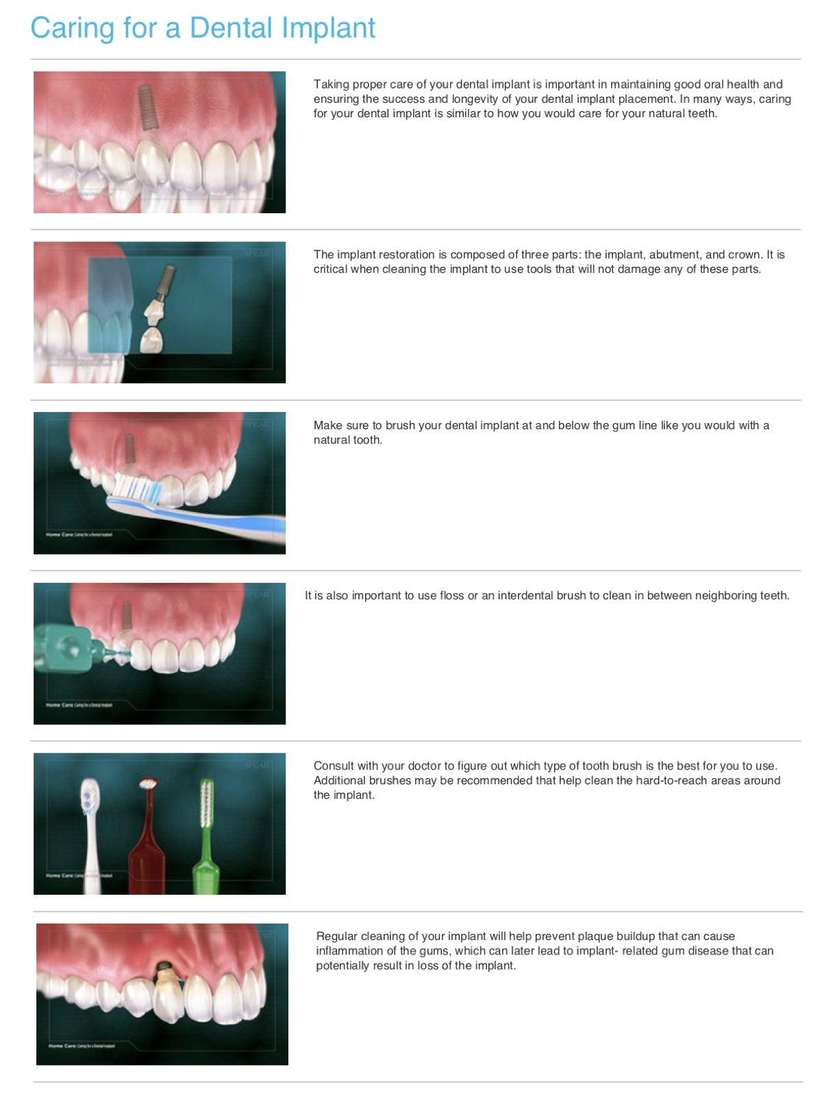 caring for a dental implant.png