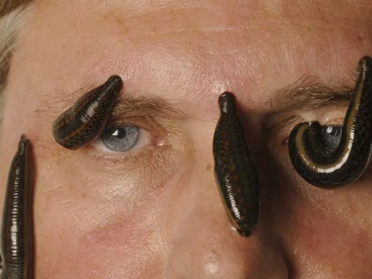 Leeches.jpg