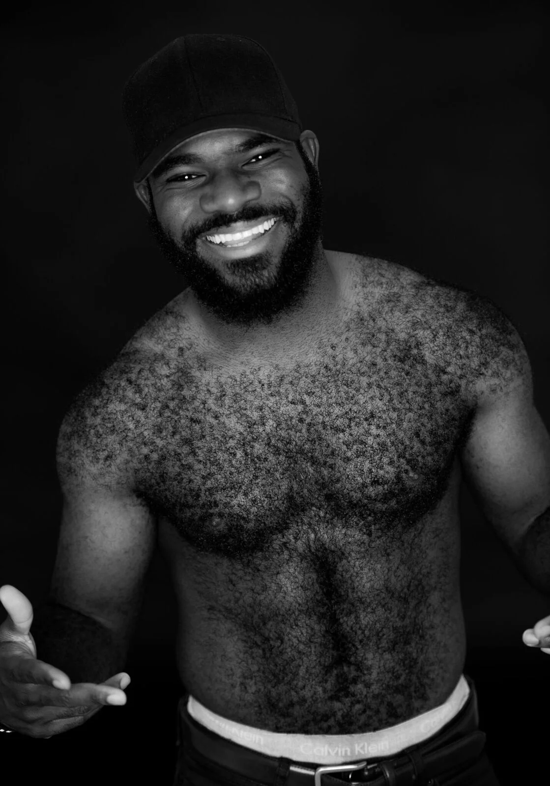 The Beast. “I actually have a lot of insecurities... One of my main ones is that I’m really hairy. It’s something that I’ve always lived with. A bunch of my friends would call me names in high school, like “beast”, “Wolverine” and “Frodo”, which I t…