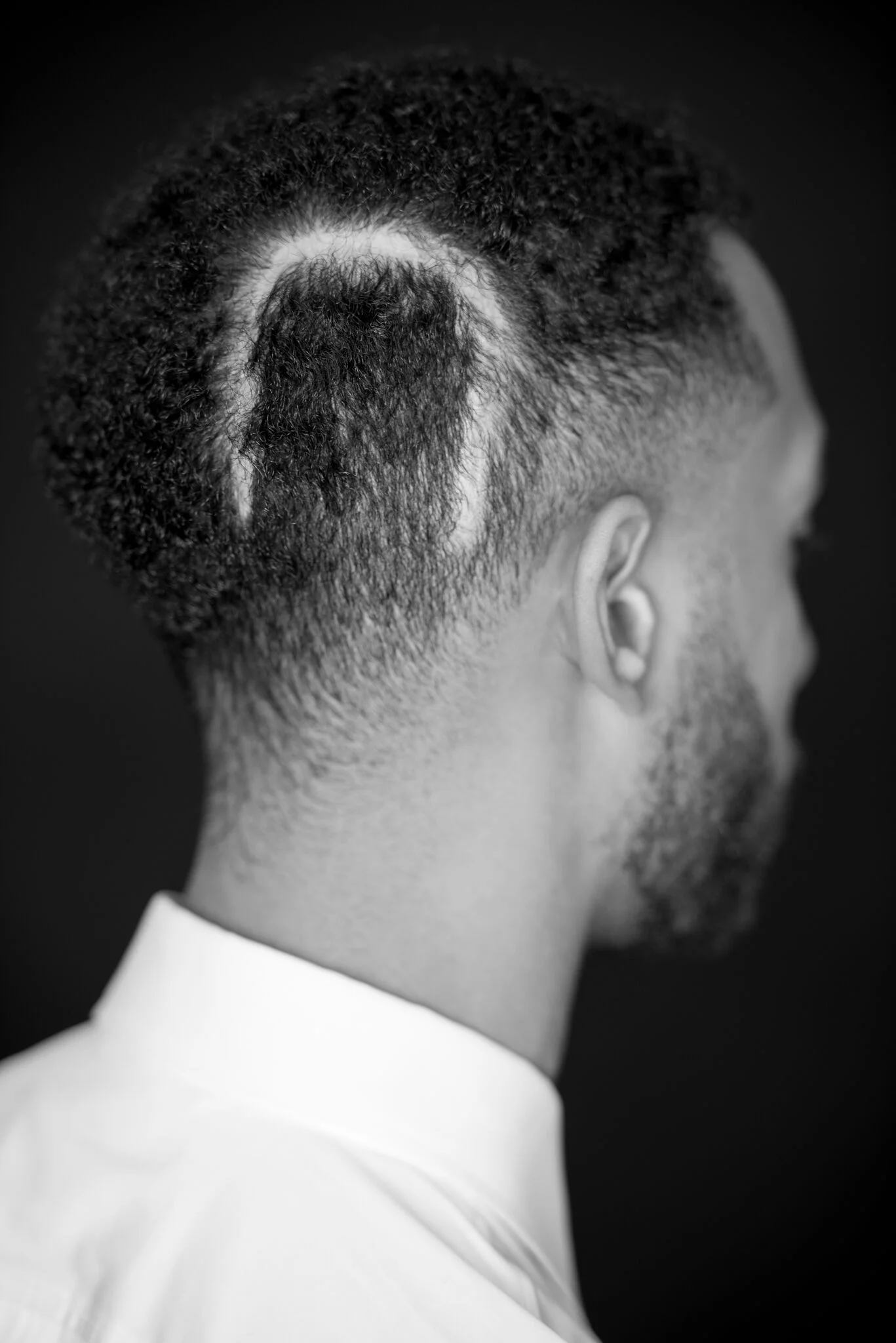 Horseshoe. “I’ve been insecure about the scar I received from my brain aneurysm surgery. Because of the shape, I was teased when I returned to school in third grade after my surgery. As I grew up, I learned that it didn’t define me. It was more abou…