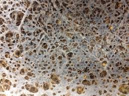 wax moth damage.jpg