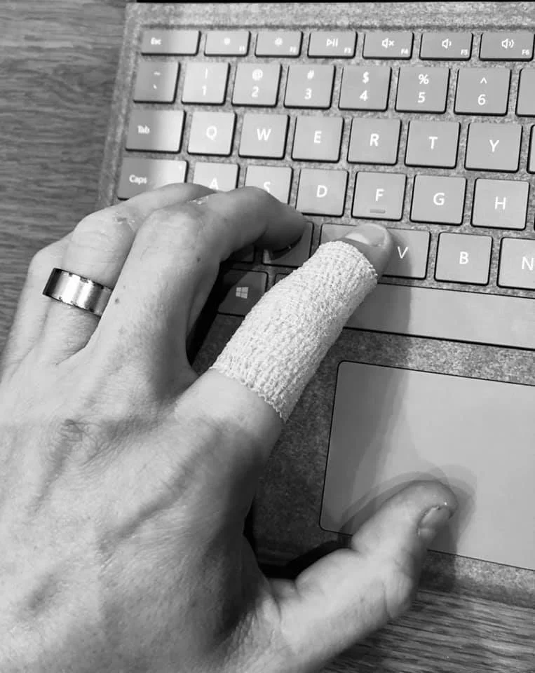 sprained finger.jpg