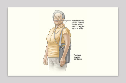 current day oxygen therapy devices