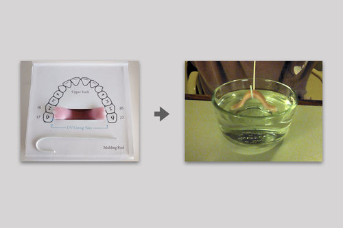 moldable hearing aid