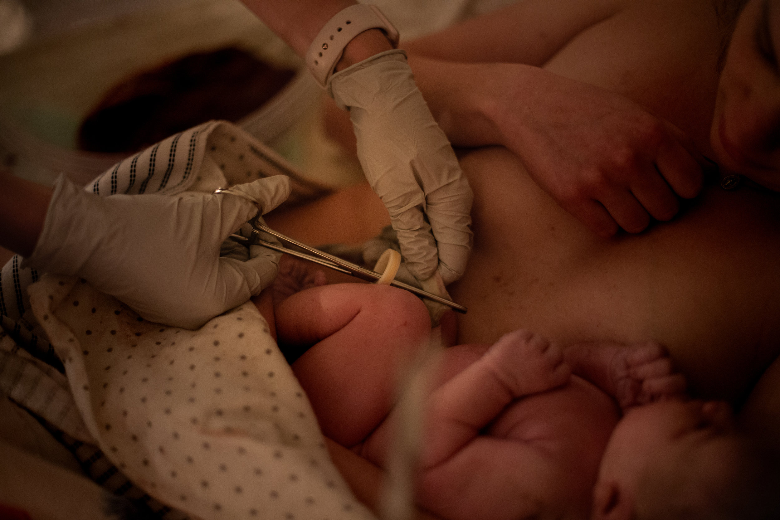 Home birth midwife cutting an umbilical cord. 