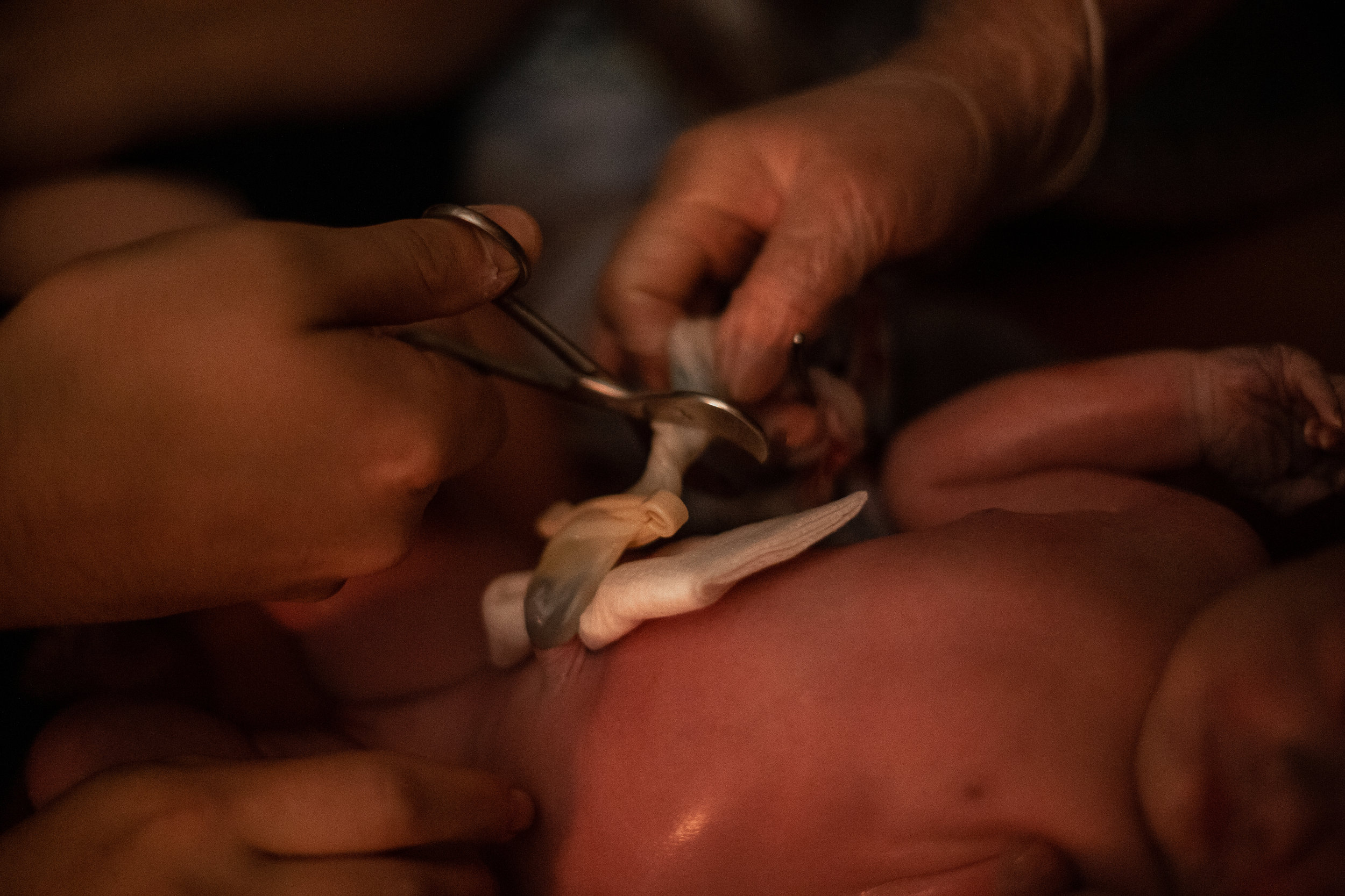 Midwife cutting umbilical cord in labor tub. 