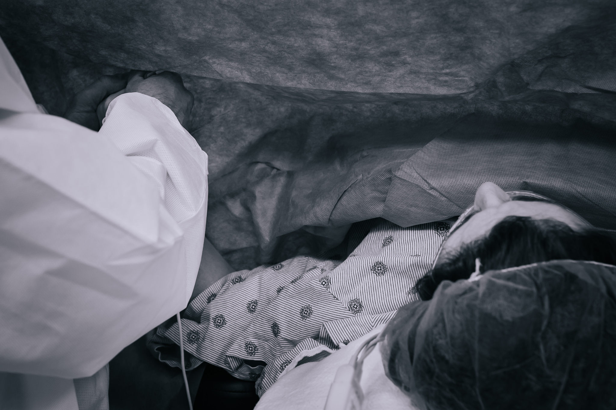 black and white image of a woman and the drape during a c-section.
