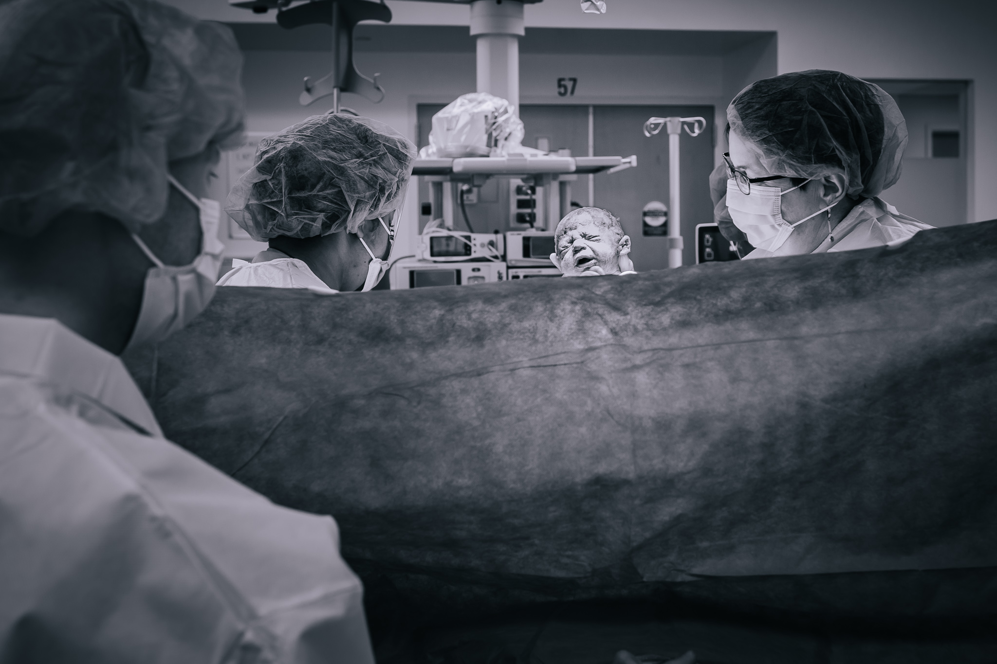 Black and white image of newborn emerging over drape of cesarean section. 