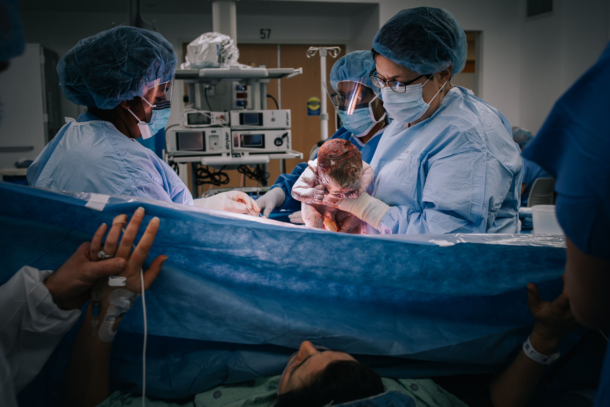 Doctor holding newborn above drape during c-section. 