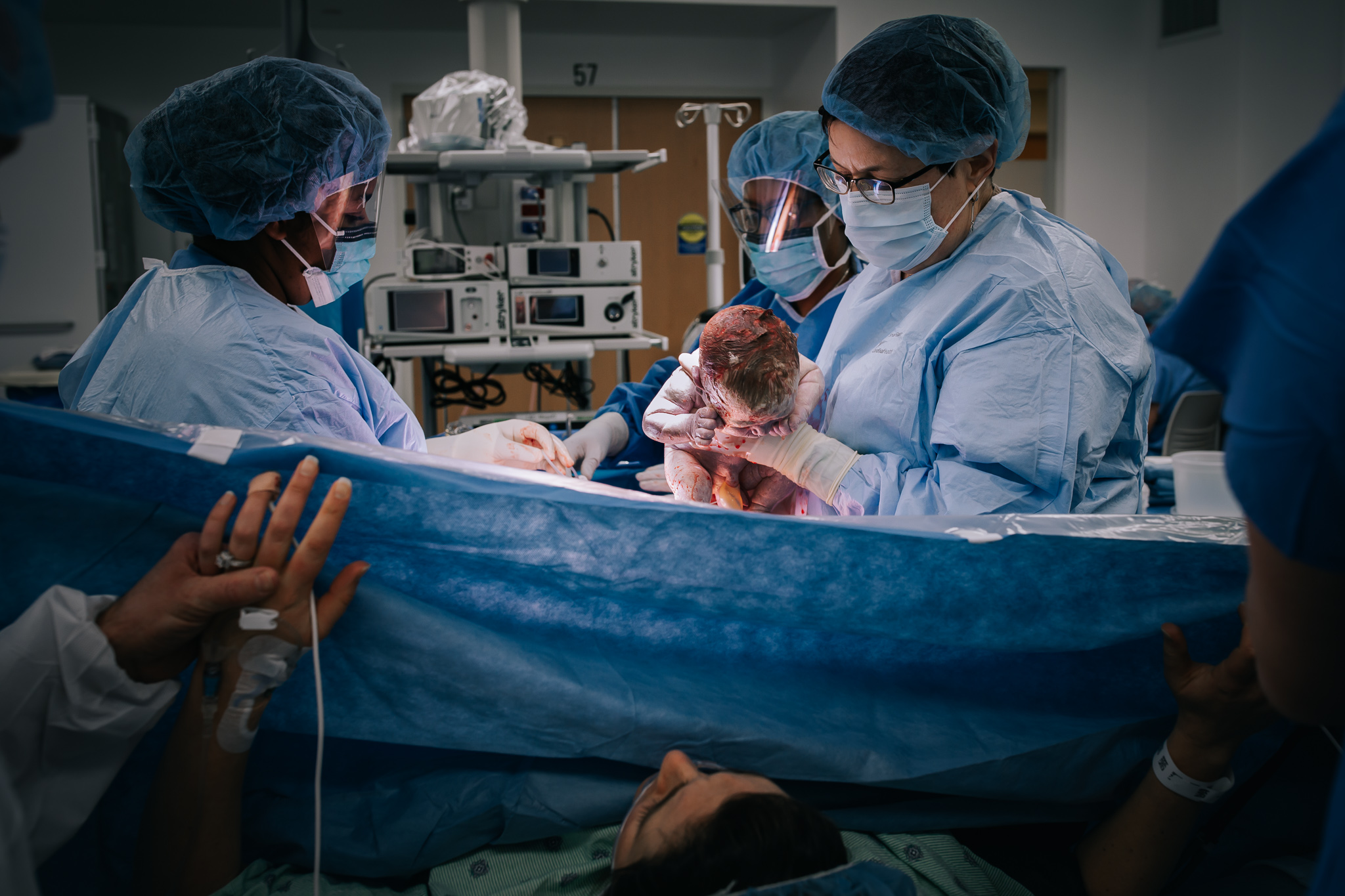 Doctor holding newborn above drape during c-section.