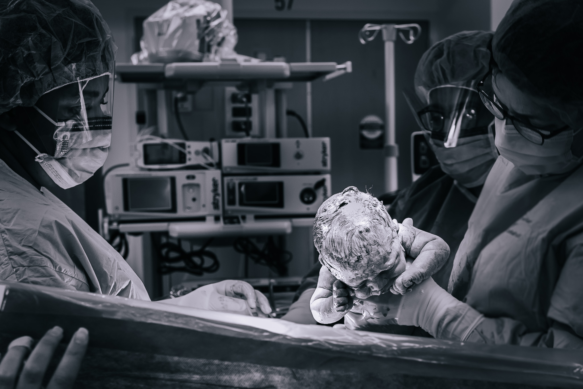 Gentle cesarean section in Buffalo, NY.