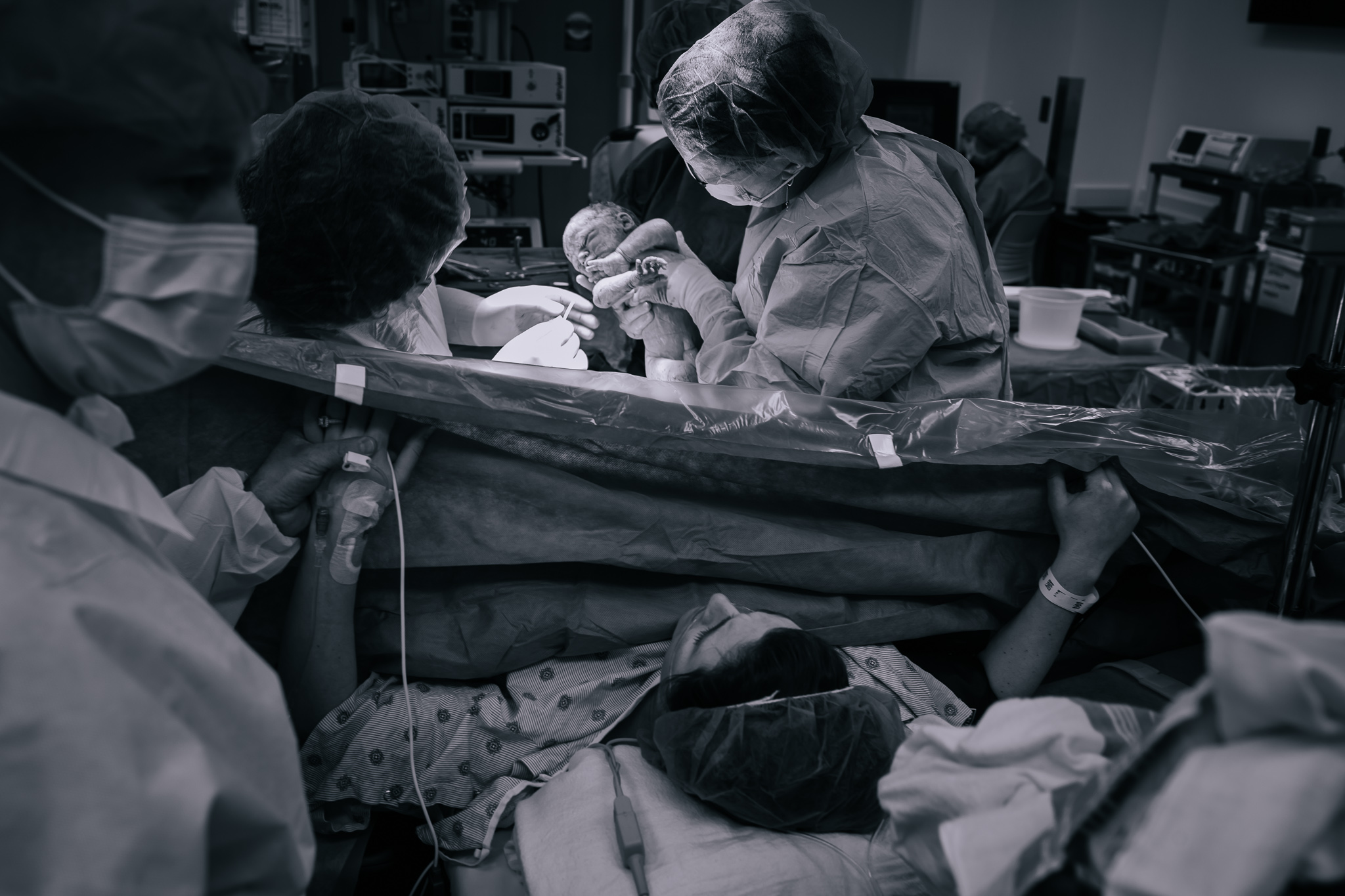 The doctors in Oishei Hospital perform c-section.