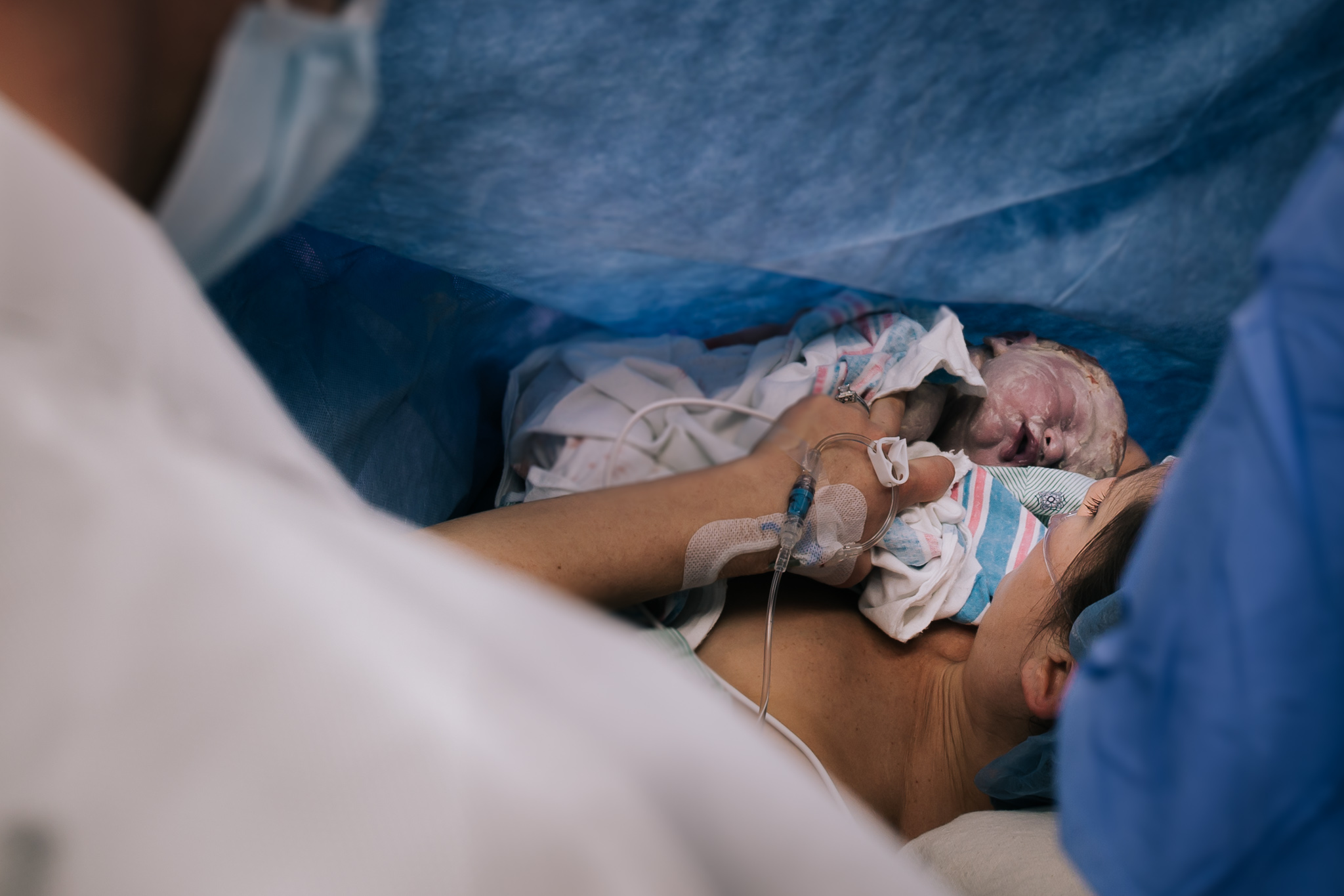 Newborn skin to skin in c-section in Buffalo, NY.