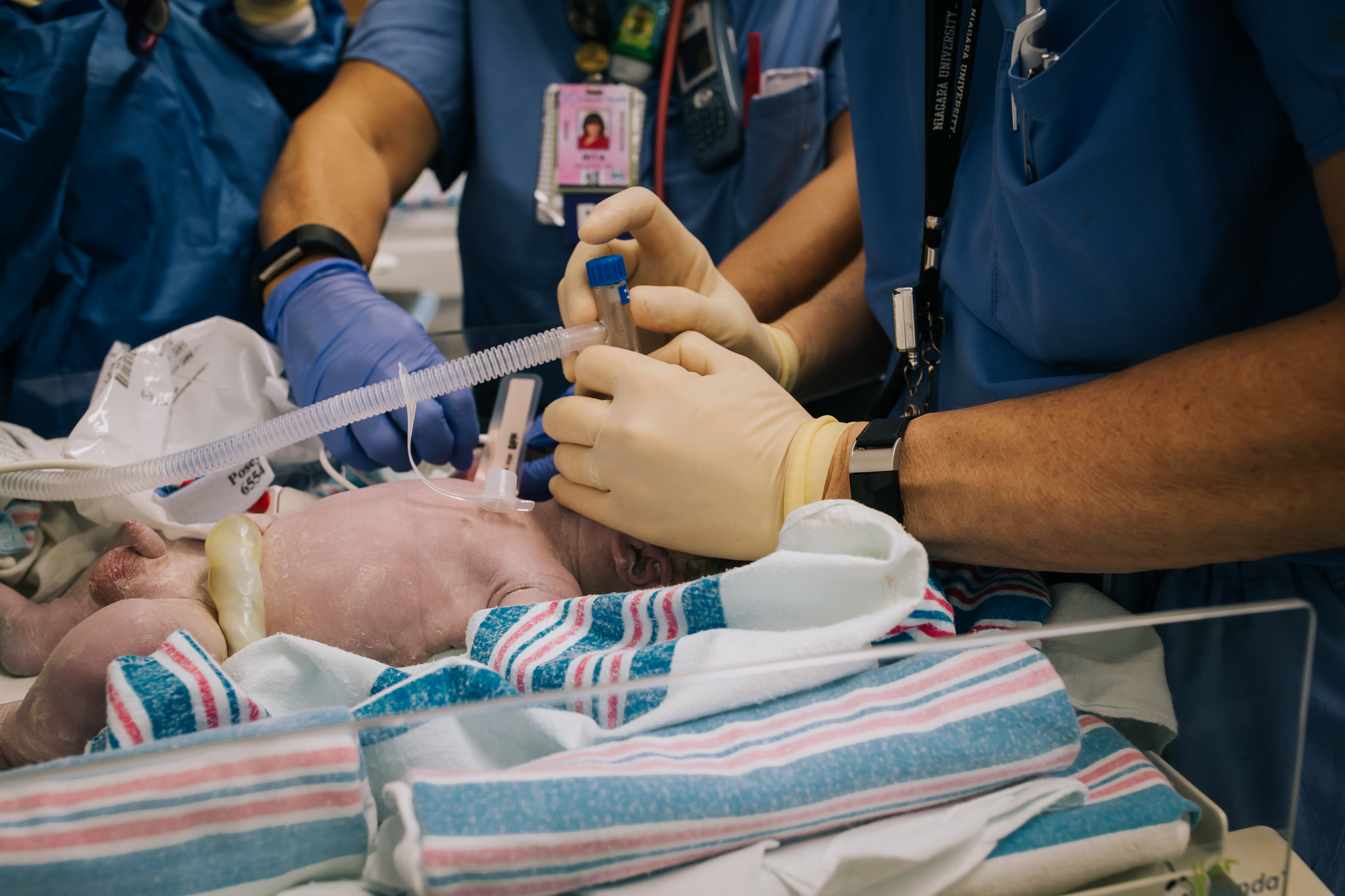 Newborn getting positive pressure ventilation in hospital operating room. 