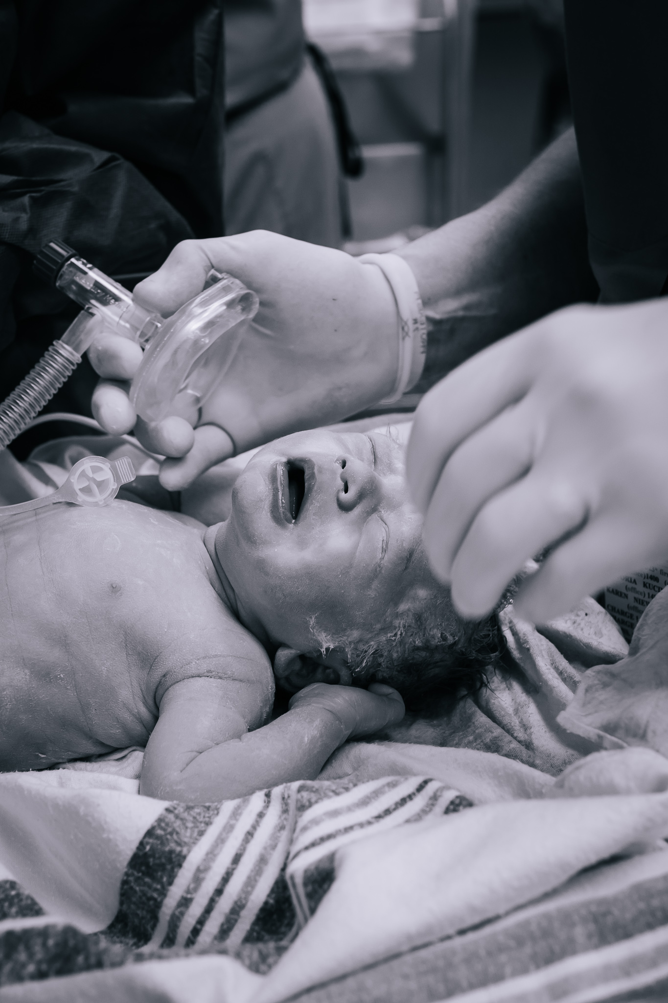 A newborn with an oxygen mask and NICU nurses. 