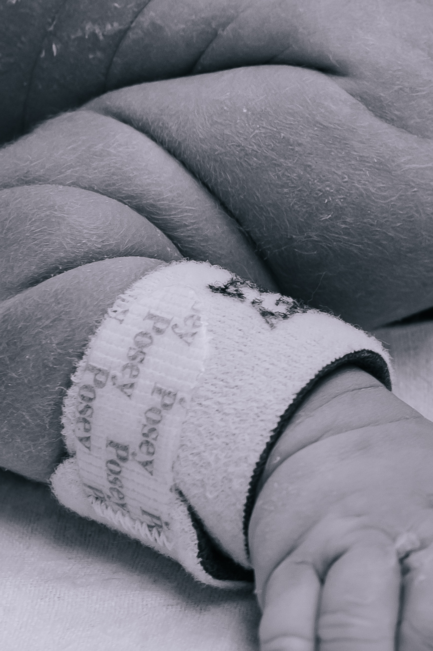 A newborn baby's arm rolls. 