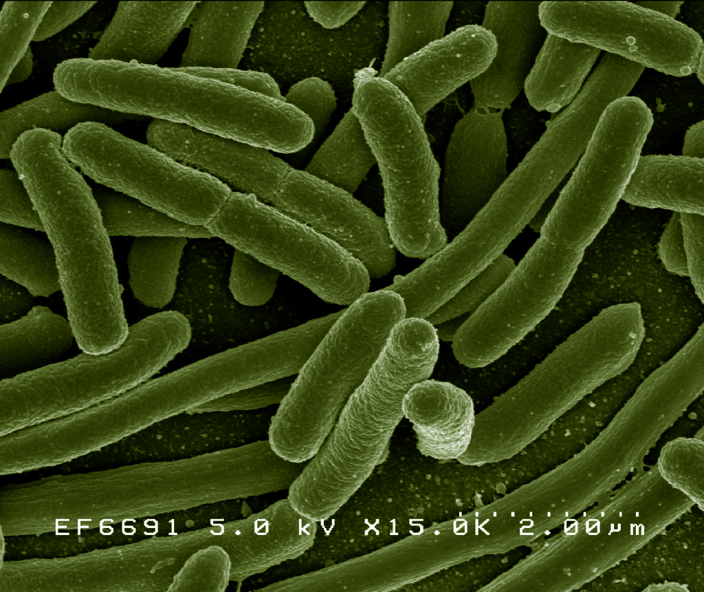 EscherichiaColi_NIAID-gr.jpg