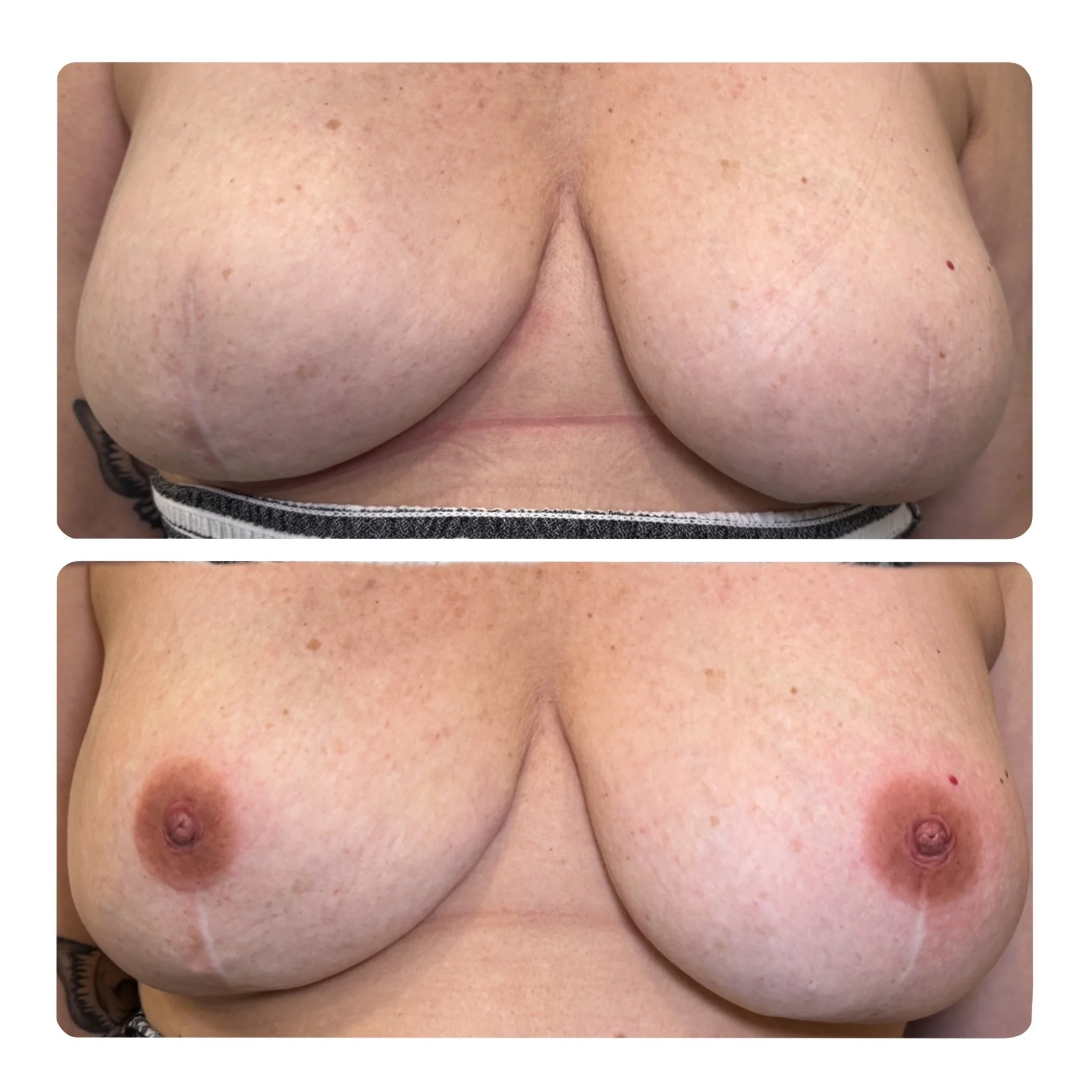 Breast cancer tattoos kelowna
