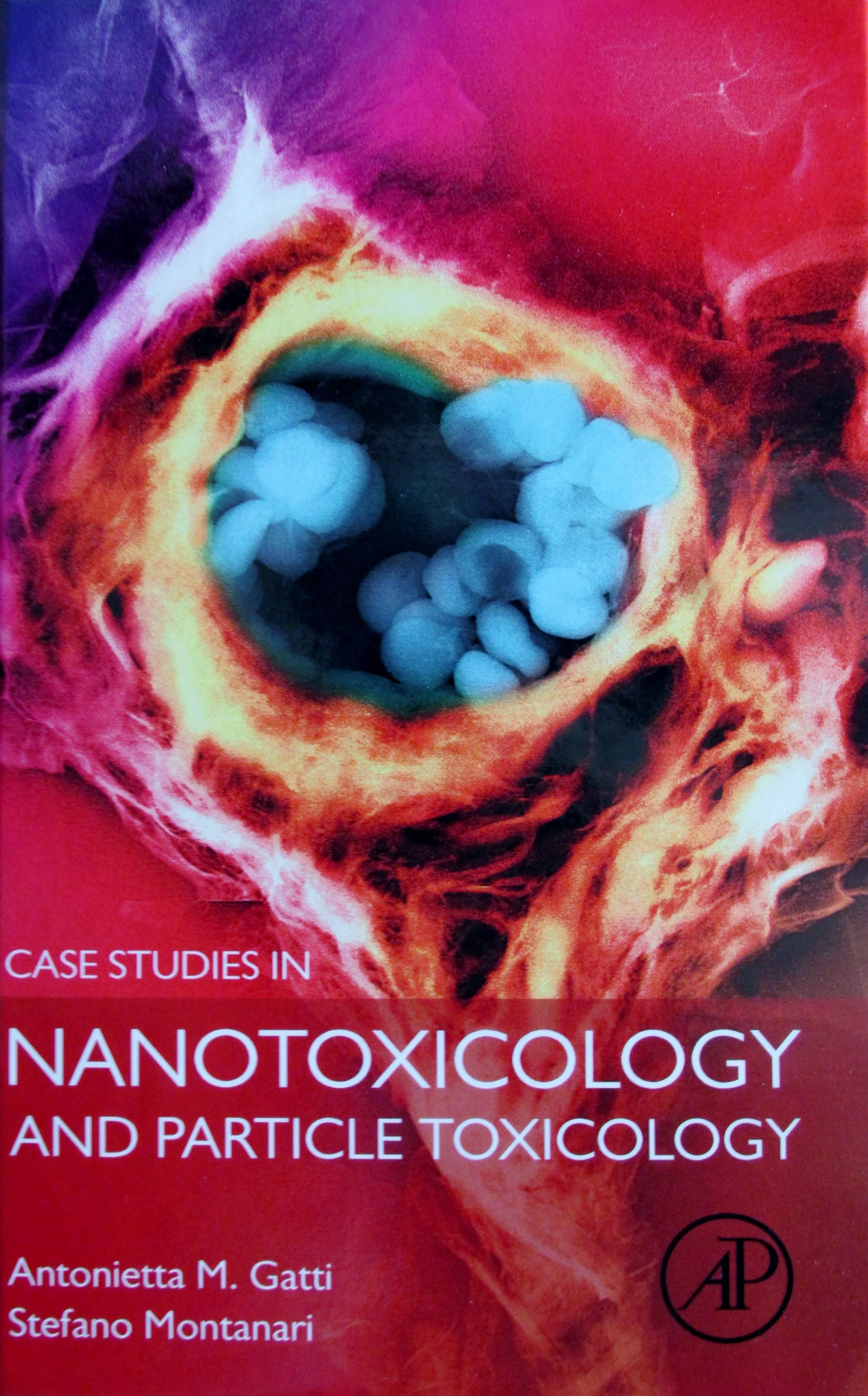 Nanocontamination of vaccine as the cause of bone cancer in an eight-year-old child? 